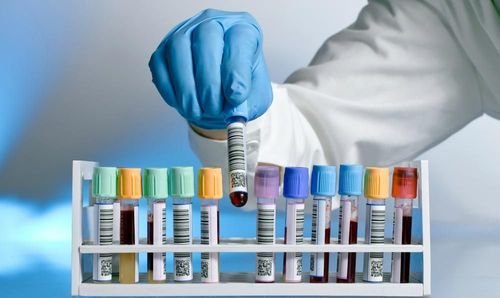 Hälsokontroller - förebyggande hälsovård i en digital era