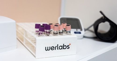 Därför bör du göra en hälsokontroll regelbundet